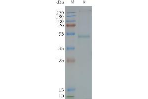 Human GRPR-Nanodisc, Flag Tag on SDS-PAGE (GRPR Protéine)