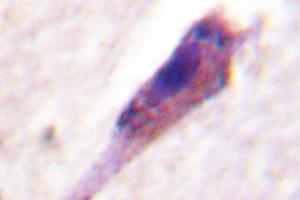 Image no. 1 for anti-Arrestin, beta 1 (ARRB1) antibody (ABIN271995) (beta Arrestin 1 anticorps)