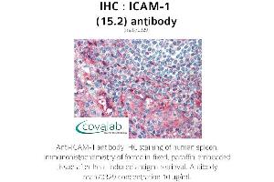 Image no. 2 for anti-Intercellular Adhesion Molecule 1 (ICAM1) antibody (ABIN1723250) (ICAM1 anticorps)