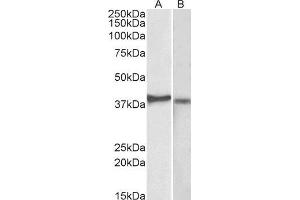 ABIN2562069 (2µg/ml) staining of Kelly (A) and U251-MG (B) lysates (35µg protein in RIPA buffer). (CX3CR1 anticorps  (N-Term))
