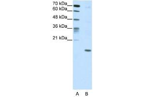 DUX5 antibody (20R-1209) used at 0. (DUX5 anticorps  (C-Term))