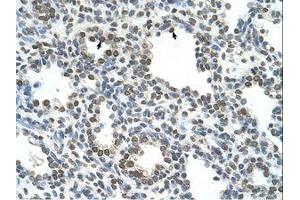 Image no. 1 for anti-Naked Cuticle Homolog 1 (NKD1) (AA 65-114) antibody (ABIN6739155) (NKD1 anticorps  (AA 65-114))
