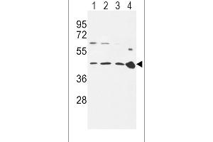 Western Blotting (WB) image for anti-Chemokine (C-C Motif) Receptor 7 (CCR7) (AA 11-37), (N-Term) antibody (ABIN651190)