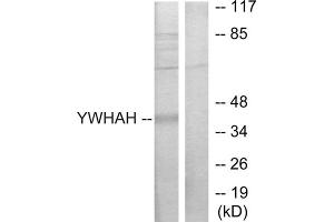 Western blot analysis of extracts from Jurkat cells, using 14-3-3 eta antibody. (14-3-3 eta anticorps  (Internal Region))