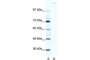 Western Blotting (WB) image for anti-Zinc Finger Protein GLI1 (GLI1) antibody (ABIN2460438) (GLI1 anticorps)