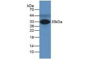 Detection of FCN3 in Human Serum using Polyclonal Antibody to Ficolin 3 (FCN3) (FCN3 anticorps  (AA 34-297))