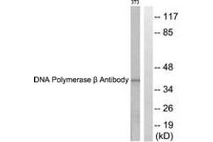 Western blot analysis of extracts from NIH-3T3 cells, using DNA Polymerase beta Antibody. (POLB anticorps  (AA 286-335))