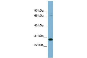 WB Suggested Anti-TMEM176A Antibody Titration:  0. (TMEM176A anticorps  (Middle Region))