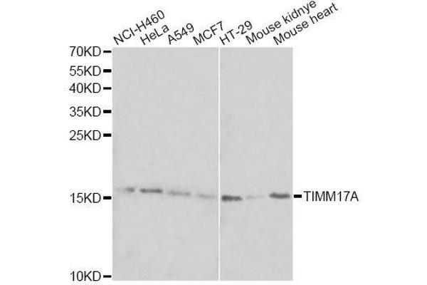 TIMM17A anticorps  (AA 1-171)