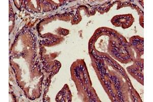 Immunohistochemistry of paraffin-embedded human prostate tissue using ABIN7149984 at dilution of 1:100 (DPP4 anticorps  (AA 473-588))