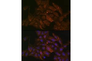 Immunofluorescence analysis of U2OS cells using KRAS+HRAS+NRAS Rabbit mAb (ABIN7267531) at dilution of 1:100 (40x lens). (GTPase NRas anticorps)