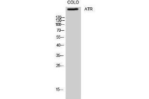 Western Blotting (WB) image for anti-ATR serine/threonine kinase (ATR) (Ser16) antibody (ABIN3173961) (ATR anticorps  (Ser16))