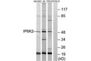 Western blot analysis of extracts from HuvEc/COLO/Jurkat cells, using IP6K2 Antibody. (IP6K2 anticorps  (AA 161-210))