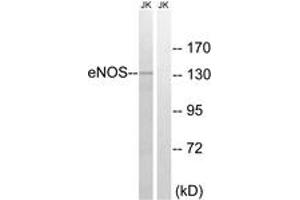 Western Blotting (WB) image for anti-Nitric Oxide Synthase 3 (Endothelial Cell) (NOS3) (AA 1144-1193) antibody (ABIN2888981) (ENOS anticorps  (AA 1144-1193))