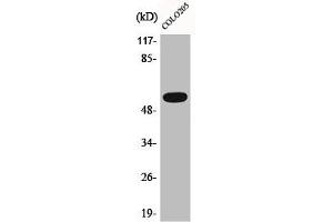 Western Blot analysis of COLO205 cells using Phospho-Akt (T308) Polyclonal Antibody (AKT 1/2/3 anticorps  (pThr308))