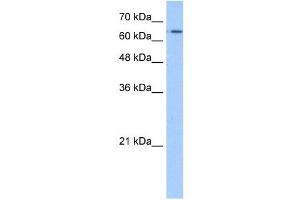 WB Suggested Anti-SLC22A11 Antibody Titration:  1. (SLC22A11 anticorps  (N-Term))