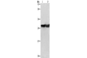 Western Blotting (WB) image for anti-Calbindin (CALB1) antibody (ABIN2429661) (CALB1 anticorps)