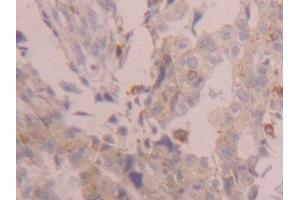 Used in DAB staining on fromalin fixed paraffin-embedded Kidney tissue (Cathepsin D anticorps  (AA 23-161))