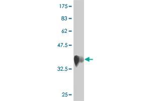 Western Blot detection against Immunogen (36. (RNFT1 anticorps  (AA 1-100))