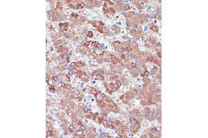 Immunohistochemistry of paraffin-embedded Human liver using B3GNT3 Rabbit pAb (ABIN7271204) at dilution of 1:100 (40x lens). (B3GNT3 anticorps  (AA 120-240))