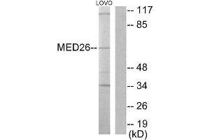 Western Blotting (WB) image for anti-Mediator Complex Subunit 26 (MED26) (N-Term) antibody (ABIN1849071) (MED26 anticorps  (N-Term))