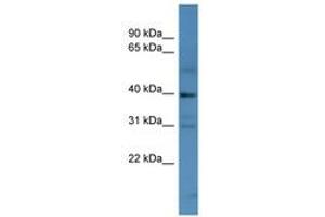 Image no. 1 for anti-Melanoma Antigen Family C, 2 (MAGEC2) (AA 102-151) antibody (ABIN6746702) (MAGEC2 anticorps  (AA 102-151))