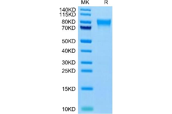 PLXDC2 Protein (AA 31-454) (His tag)