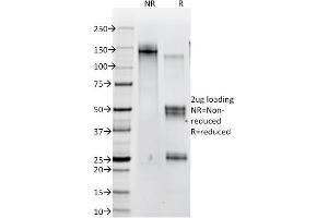 SDS-PAGE Analysis of Purified Catenin, beta Mouse Monoclonal Antibody (12F7). (CTNNB1 anticorps  (N-Term))