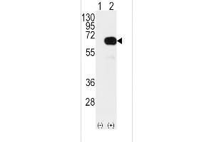 Western blot analysis of SD4 Antibody (arrow) using rabbit polyclonal SD4 Antibody  (ABIN392165 and ABIN2841882). (SMAD4 anticorps  (AA 255-284))