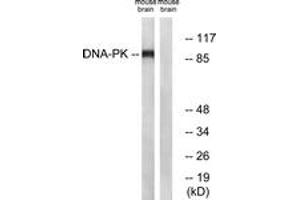 Western Blotting (WB) image for anti-Dynamin 1 (DNM1) (AA 740-789) antibody (ABIN2888626) (Dynamin 1 anticorps  (AA 740-789))