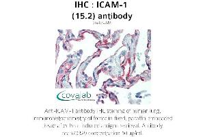 Image no. 1 for anti-Intercellular Adhesion Molecule 1 (ICAM1) antibody (ABIN1723250) (ICAM1 anticorps)