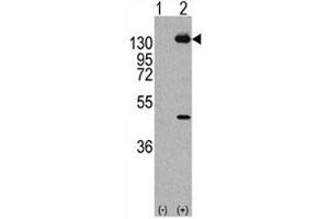 Western blot analysis of PDGFRA antibody and293 cell lysate (2 ug/lane) either nontransfected (Lane 1) or transiently transfected with the human gene (2). (PDGFRA anticorps  (AA 746-775))