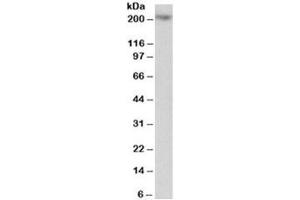 Western blot testing of Jurkat lysate with MYO5A antibody at 1ug/ml. (MYO5A anticorps)