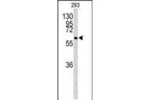 Western blot analysis of CDC73 Antibody (Center) (ABIN653128 and ABIN2842707) in 293 cell line lysates (35 μg/lane). (HRPT2 anticorps  (AA 132-161))