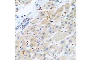 Immunohistochemistry of paraffin-embedded human liver using RGS5 antibody (ABIN5975077) at dilution of 1/100 (40x lens). (RGS5 anticorps)