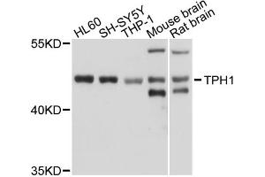 Western blot analysis of extracts of various cell lines, using TPH1 antibody (ABIN1875176) at 1:1000 dilution. (Tryptophan Hydroxylase 1 anticorps)