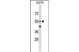 Western blot analysis in A375 cell line lysates (35ug/lane). (CNDP1 anticorps  (AA 142-170))