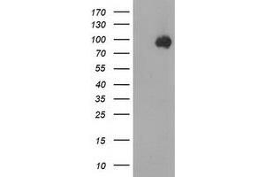 HEK293T cells were transfected with the pCMV6-ENTRY control (Left lane) or pCMV6-ENTRY CTNNB1 (Right lane) cDNA for 48 hrs and lysed. (CTNNB1 anticorps)