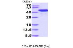 SDS-PAGE (SDS) image for Histone Deacetylase 8 (HDAC8) (AA 1-377) protein (His tag) (ABIN6387962) (HDAC8 Protein (AA 1-377) (His tag))