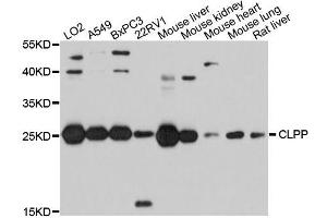 Western blot analysis of extracts of various cell lines, using CLPP antibody (ABIN5995818) at 1/1000 dilution. (CLPP anticorps)