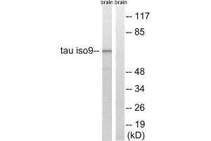 Western Blotting (WB) image for anti-tau Protein (Thr217), (Thr534) antibody (ABIN1848202) (tau anticorps  (Thr217, Thr534))