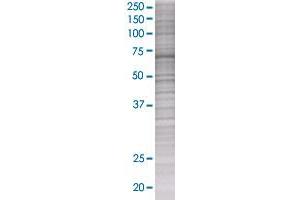 PCK1 transfected lysate. (PCK1 293T Cell Transient Overexpression Lysate(Denatured))