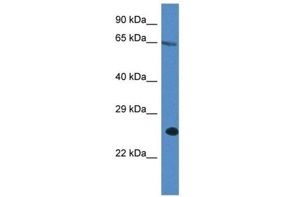 ITPRIP anticorps  (C-Term)