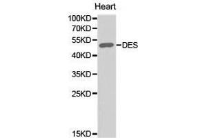 Western Blotting (WB) image for anti-Desmin (DES) antibody (ABIN1872252) (Desmin anticorps)