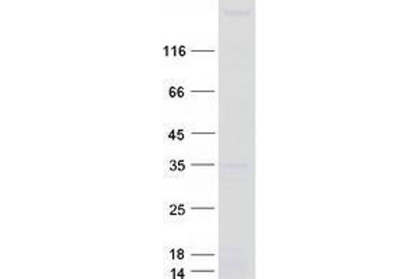 TTBK1 Protein (Myc-DYKDDDDK Tag)