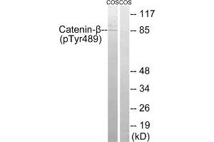 Western blot analysis of extracts from COS cells, treated with UV (15mins), using Catenin- beta (Phospho-Tyr489) antibody. (beta Catenin anticorps  (pTyr489))