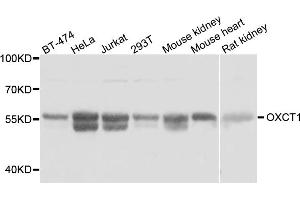 Western blot analysis of extracts of various cell lines, using OXCT1 antibody (ABIN5974499) at 1:3000 dilution. (OXCT1 anticorps)