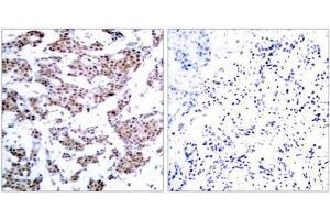 Image no. 2 for anti-Myocyte Enhancer Factor 2A (MEF2A) (pThr312) antibody (ABIN196683) (MEF2A anticorps  (pThr312))