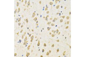 Immunohistochemistry of paraffin-embedded mouse brain using PTPRE antibody (ABIN2564811) at dilution of 1:100 (40x lens). (PTPRE anticorps)