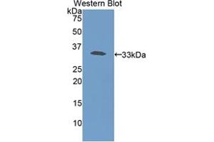 Western blot analysis of the recombinant protein. (Haptoglobin anticorps  (AA 70-332))